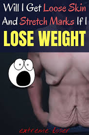 Pin On Weight Loss Tips And Tricks