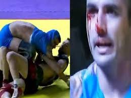 Asiad 2018: Indian kabaddi captain Ajay Thakur left bloody-faced after  horrific injury against Iran