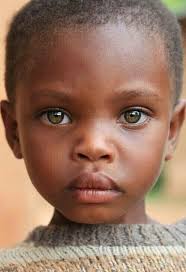 Blacks with hazel eyes a rare phenomenon