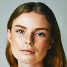 Image result for Freckles