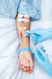 Iv drug administration is a. Infusion Therapy Iv Complications