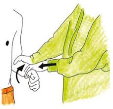 Image result for Yergason Test