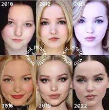Rate Dove Cameron before and after plastic surgery : r/VindictaRateCelebs