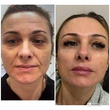 Junegaskinaesthetics