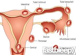 Pin On Ob Gyne Images
