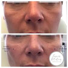 Susan Kitchen Aesthetics