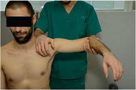 Image result for Shoulder Instability Exam