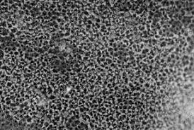 Some have been increased up to 5,000 times! Normal Human Lens Epithelium Cells Under Light Microscope Download Scientific Diagram