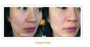 We did not find results for: Perricone Md Official Site Anti Aging Skin Care Supplements Anti Aging Skin Care Perricone Perricone Md