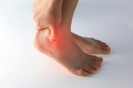 Image result for gout symptoms toe