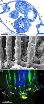 Key Novelties In The Evolution Of The Aquatic Colonial Phylum Bryozoa Evidence From Soft Body Morphology Schwaha 2020 Biological Reviews Wiley Online Library
