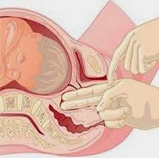 Apabila usia kehamilan anda sudah mencecah 9 bulan dan berada dalam trimester terakhir, doktor akan melalukan satu pemeriksaan terhadap kandungan. Ada Bukaan Serviks Tanda Anda Dah Nak Bersalin June 2021 Kelabmama Malaysia