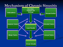 current concepts in the management of chronic sinusitis