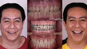 Oris Digital Dentistry (@orisdigitaldentistry) · Santa Ana