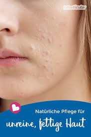 @ gesichtswasser selber machen ist ganz einfach. Einfache Naturliche Hautpflege Fur Unreine Und Fettige Haut