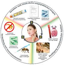 Dieser pinnwand folgen 599 nutzer auf pinterest. Management Der Anaphylaxie Akuttherapie Und Langfristige Massnahmen Arztcme