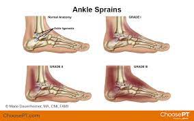 Guide | Physical Therapy Guide To Ankle Sprain | Choose Pt