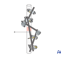 Modular external fixation
