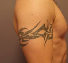 All natural tattoo removal methods — other options for removing tattoos at home include applying lemon juice, honey or a mixture of aloe vera, paederia tomentosa, and vitamin e. What Are The Typical Results From Laser Tattoo Removal After One Treatment The Untattoo Parlor