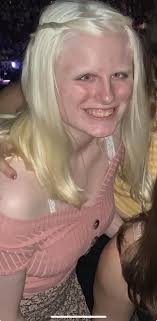 People being mean about my pixie cut