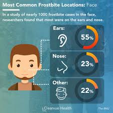 48.2 how long does it take to do these things? 3 Charts Frost Bite On Your Face Statistics Prevention