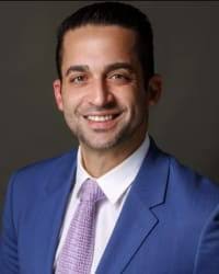 Top Rated Calabasas, CA Personal Injury Attorney