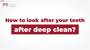 Check spelling or type a new query. Look After Your Teeth After Deep Cleaning