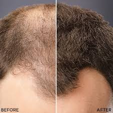 You don't need to shampoo every day, even if you work out. See The New Hair Products From Toppik