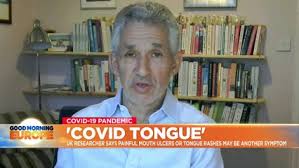 Learn the symptoms of covid tongue and whether experts think its a true sign of coronavirus. Covid Tongue Mouth Ulcers Or Rashes Likely A Coronavirus Symptom Says Expert Euronews