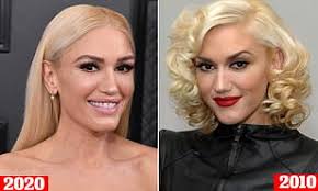 Before placing against the skin, put a cloth between your skin and the ice. Gwen Stefani Fans Insist She Looks Unrecognizable At Grammys And Accuse Of Her Plastic Surgery Daily Mail Online