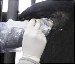 Image result for Pudendal Block