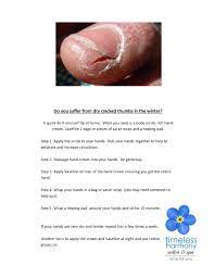 Do You Suffer From Dry Cracked Hands In The Winter Timeless Harmony Salon Spa Newmarket Dry Cracked Hands Dry Hands Remedy Cracked Hands