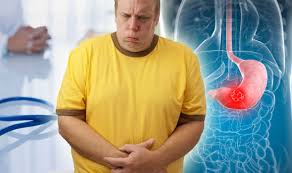 Surgery to relieve signs and symptoms. Stomach Cancer Symptoms Signs You Could Be Suffering With Disease Express Co Uk