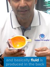 How does glaucoma quietly steal your vision? In part 1 of this series, Dr.  Bhola explains what causes glaucoma and how it affects the eye.  @teh.optical #GlaucomaAwarenessMonth #EyeCareTips ...