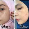 Đối với những bạn sau khi bị mụn để lại nhiều vết thâm, thì nên dùng sữa rửa mặt trắng da eucerin white therapy cleansing foam. 1