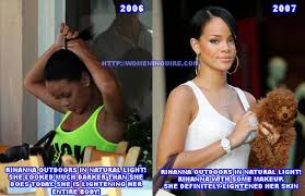 Before And After Black And White Bleaching Cream Reviews White Chic Glutathiones Lighten Skin Skin Bleaching Good Skin