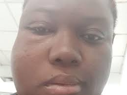 Fundraiser for Ebenezer Appiah by Ewurabena Damoah Appiah : Rabs road to  recovery