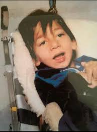 Can someone remove scratches from old photo?