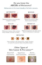 skin cancer is caused by an uncontrolled growth of abnormal skin cells. Skin Cancer Warning Signs Associates In Dermatology