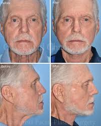 Columbia Facial Plastic Surgery