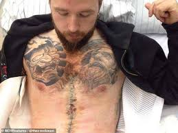 Maybe you would like to learn more about one of these? La Man Loses 330lbs And Becomes Model After Covering Up Weight Loss Surgery Scars With Tattoos Readsector