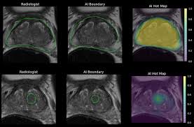 Using Full Body Mris Ezra Can Now Detect 11 Cancers In Men And 13 In Women Cancer Different Types Of Cancer Cancer Screening