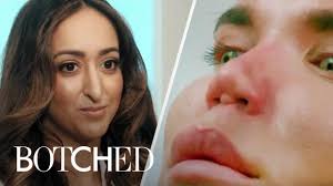 In the privacy of your own home, you can manipulate the photo of your nose to achieve the shape and look you want. The Most Intense Nose Surgeries From Botched E Youtube