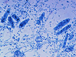 Image result for Erythrococca trichogyne