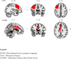 Image result for Verbal Fluency Test