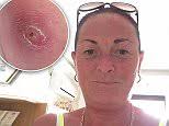 Newcastle mother-of-three was nearly killed by her SPOT