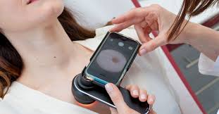 Image result for Self Skin Exam