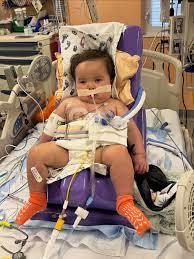 Please Join Us in Prayer and Fasting for Our Sweet Wally Boy TODAY! Our precious Wally will be having surgery on November 19th for a trach and strabismus. We are asking if