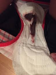 Image result for reasons why blood flow come out during menstruation period