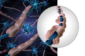Metabolomics Identifies Biomarkers For Guillain Barre Syndrome